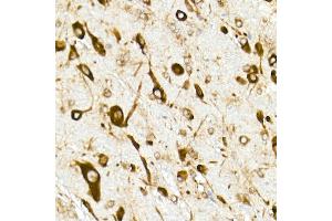 Immunohistochemistry of paraffin-embedded rat brain using RPL10A Rabbit mAb (ABIN7269992) at dilution of 1:25 (40x lens). (RPL10A antibody)