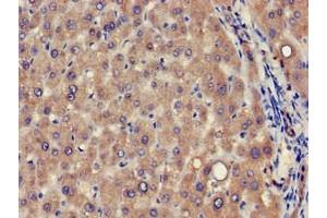 Immunohistochemistry of paraffin-embedded human liver tissue using ABIN7175353 at dilution of 1:100 (VPS39 antibody  (AA 263-490))