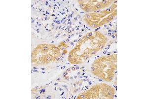 (ABIN1944892 and ABIN2838534) staining H in human kidney tissue sections by Immunohistochemistry (IHC-P - raformaldehyde-fixed, raffin-embedded sections). (Phenylalanine Hydroxylase antibody  (AA 127-161))