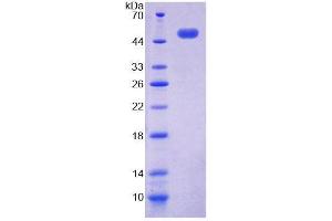 SDS-PAGE (SDS) image for Acid Phosphatase 6, Lysophosphatidic (ACP6) (AA 1-428) protein (His tag) (ABIN4989710)