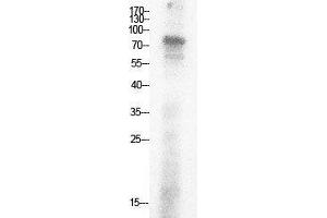 Western Blot (WB) analysis of HepG2 cells using Acetyl-Ub (K29) Polyclonal Antibody. (Ubiquitin antibody  (acLys29))