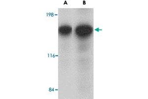 Western blot analysis of CADPS in rat brain tissue lysate with CADPS polyclonal antibody  at (A) 0.