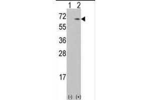 Western blot analysis of CKK1 (arrow) using rabbit polyclonal CKK1 Antibody (N-term) (ABIN392189 and ABIN2841895). (CAMKK1 antibody  (N-Term))