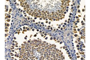 ABIN6264551 and ABIN6272407 at 1/100 staining rat testis tissue by IHC-P. (RAB11FIP4 antibody  (Internal Region))
