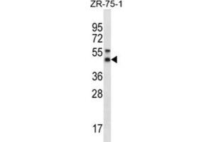 Western Blotting (WB) image for anti-Syntaxin 5 (STX5) antibody (ABIN2996624) (Syntaxin 5 antibody)