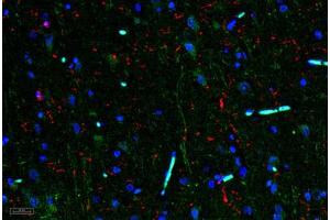 Image no. 3 for anti-Interleukin 11 (IL11) antibody (ABIN465144) (IL-11 antibody)