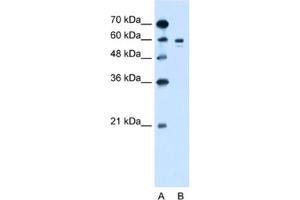Western Blotting (WB) image for anti-Tyrosinase (TYR) antibody (ABIN2462800) (TYR antibody)