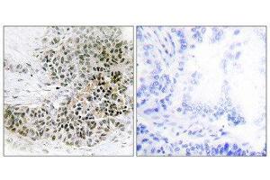 Immunohistochemistry (IHC) image for anti-Trichorhinophalangeal Syndrome I (TRPS1) (N-Term) antibody (ABIN1850056) (TRPS1 antibody  (N-Term))