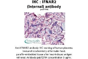 Image no. 1 for anti-Interferon alpha/beta Receptor 2 (IFNAR2) (Internal Region) antibody (ABIN1735773) (IFNAR2 antibody  (Internal Region))