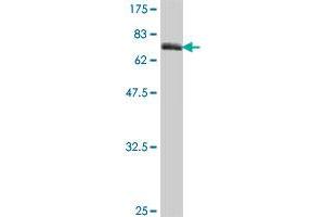 Western Blot detection against Immunogen (65. (SKAP2 antibody  (AA 1-359))