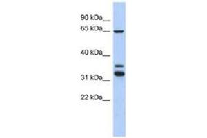 Image no. 1 for anti-S100P Binding Protein (S100PBP) (C-Term) antibody (ABIN6744009) (S100PBP antibody  (C-Term))