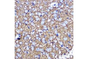 Immunohistochemistry of paraffin-embedded rat brain using SN Rabbit pAb (ABIN3021231, ABIN3021232, ABIN3021233 and ABIN6214078) at dilution of 1:100 (40x lens).