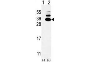 Western blot analysis of C19orf50 (arrow) using rabbit polyclonal C19orf50 Antibody (Center) . (C19orf50 antibody  (Middle Region))