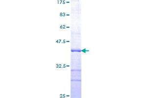 Image no. 1 for Presenilin 1 (PSEN1) (AA 280-379) protein (GST tag) (ABIN1316518) (Presenilin 1 Protein (PSEN1) (AA 280-379) (GST tag))