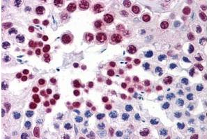 Immunohistochemistry (Formalin-fixed Paraffin-embedded Sections) (IHC (fp)) image for anti-ELAV (Embryonic Lethal, Abnormal Vision, Drosophila)-Like 1 (Hu Antigen R) (ELAVL1) (AA 1-101) antibody (ABIN574241)