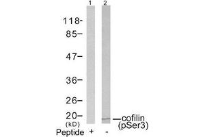 Western blot analysis of extracts from COLO205 cells using cofilin(Phospho-Ser3) Antibody(Lane 2) and the same antibody preincubated with blocking peptide(Lane1). (Cofilin antibody  (pSer3))