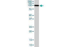 ADAM17 polyclonal antibody  staining (0. (ADAM17 antibody)