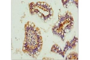 Immunohistochemistry of paraffin-embedded human small intestine tissue using ABIN7154739 at dilution of 1:100 (GNA15 antibody  (AA 1-374))