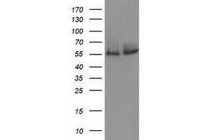 Western Blotting (WB) image for anti-Catalase (CAT) antibody (ABIN1497109) (Catalase antibody)