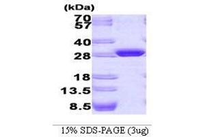 Figure annotation denotes ug of protein loaded and % gel used. (GFP Protein (AA 1-238))