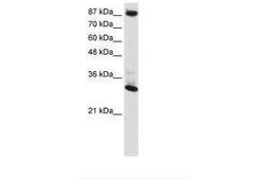 Image no. 1 for anti-CCCTC-Binding Factor (Zinc Finger Protein) (CTCF) (AA 181-230) antibody (ABIN6736144) (CTCF antibody  (AA 181-230))