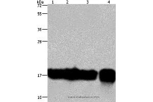 Western blot analysis of A549 and K562 cell, Raji cell and human fetal intestine tissue, using IL17C Polyclonal Antibody at dilution of 1:300