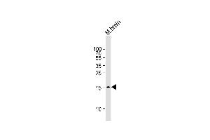 Mouse brain lysate (20µg) probed with bsm-51134M GABARAP (424CT5. (GABARAP antibody)