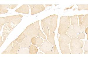 Detection of MYL3 in Human Skeletal muscle Tissue using Polyclonal Antibody to Myosin Light Chain 3, Alkali, Ventricular, Slow Skeletal (MYL3)