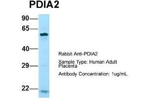 Host: Rabbit  Target Name: PDIA2  Sample Tissue: Human Adult Placenta  Antibody Dilution: 1.