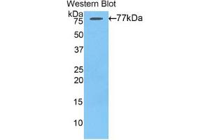 Western blot analysis of the recombinant protein. (AGT antibody  (AA 35-485))