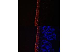 Immunofluorescence analysis of Mouse intestine using MYL9 antibody (ABIN3023462, ABIN3023463, ABIN3023464 and ABIN6220005) at dilution of 1:100. (MYL9 antibody  (AA 1-100))