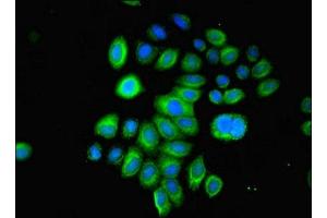 Immunofluorescent analysis of A549 cells using ABIN7153440 at dilution of 1:100 and Alexa Fluor 488-congugated AffiniPure Goat Anti-Rabbit IgG(H+L) (LGALS1/Galectin 1 antibody  (AA 2-135))