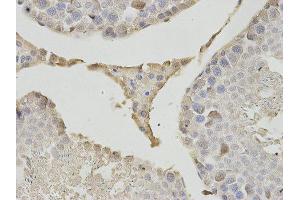 Immunohistochemistry (IHC) image for anti-Proteasome (Prosome, Macropain) Subunit, beta Type, 1 (PSMB1) antibody (ABIN1875399)