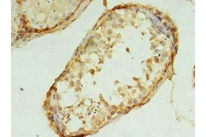 Immunohistochemistry of paraffin-embedded human testis tissue using ABIN7173289 at dilution of 1:100 (TMEM9 antibody  (AA 111-183))