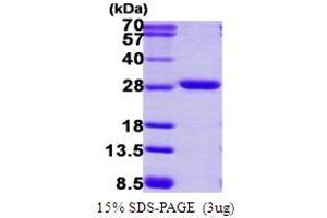 SDS-PAGE (SDS) image for Proteasome Subunit alpha 2 (PSMA2) (AA 1-234) protein (His tag) (ABIN667572) (PSMA2 Protein (AA 1-234) (His tag))