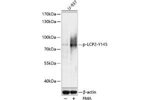 Western blot analysis of extracts of U937 cells, using Phospho-LCP2-Y145 antibody (ABIN7268318) at 1:1000 dilution. (LCP2 antibody  (pTyr145))