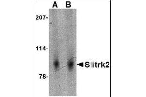 Western blot analysis of Slitrk2 in mouse brain tissue lysate with this product at (A) 1 and (B) 2 μg/ml. (SLITRK2 antibody  (Middle Region))