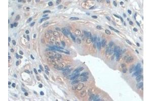 Immunohistochemistry (IHC) image for anti-Interleukin 22 Receptor, alpha 2 (IL22RA2) (AA 31-223) antibody (ABIN7435862)