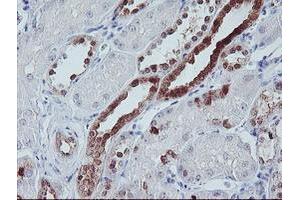 Image no. 2 for anti-Interferon Regulatory Factor 6 (IRF6) antibody (ABIN1498901) (IRF6 antibody)