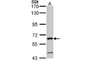 WB Image Sample (30 ug of whole cell lysate) A: Hep G2 , 7. (Intestinal Alkaline Phosphatase antibody)