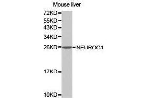 Western Blotting (WB) image for anti-Neurogenin 1 (NEUROG1) antibody (ABIN1873884) (Neurogenin 1 antibody)