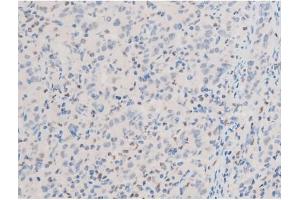 Immunohistochemistry (IHC) image for anti-GATA Binding Protein 4 (GATA4) (pSer262) antibody (ABIN6256227)