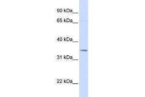 WB Suggested Anti-TOLLIP Antibody Titration: 0.