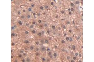 Figure. (PPARG antibody  (AA 157-274))