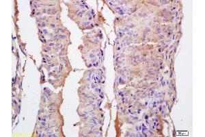 Formalin-fixed and paraffin embedded rat testis labeled with Rabbit Anti EPHA10 Polyclonal Antibody, Unconjugated (ABIN1714266) at 1:200 followed by conjugation to the secondary antibody and DAB staining (EPH Receptor A10 antibody  (AA 151-250))