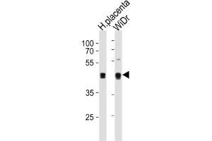 Western Blotting (WB) image for anti-SAP30 Binding Protein (SAP30BP) antibody (ABIN3004651) (SAP30BP antibody)