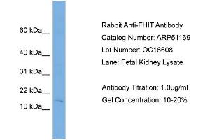 WB Suggested Anti-FHIT  Antibody Titration: 0. (FHIT antibody  (Middle Region))