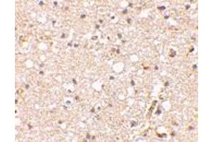 Immunohistochemical staining of human brain tissue using GRIK1 polyclonal antibody  at 2. (GRIK1 antibody  (Internal Region))