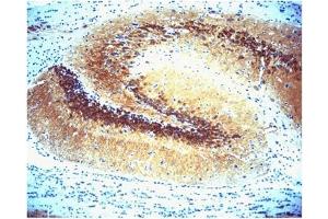 Immunohistochemistry (IHC) image for anti-Calcium/calmodulin-Dependent Protein Kinase II alpha (CAMK2A) (AA 448-460) antibody (ABIN968458) (CAMK2A antibody  (AA 448-460))