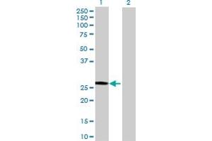 Western Blot analysis of SART3 expression in transfected 293T cell line (SART3 antibody)